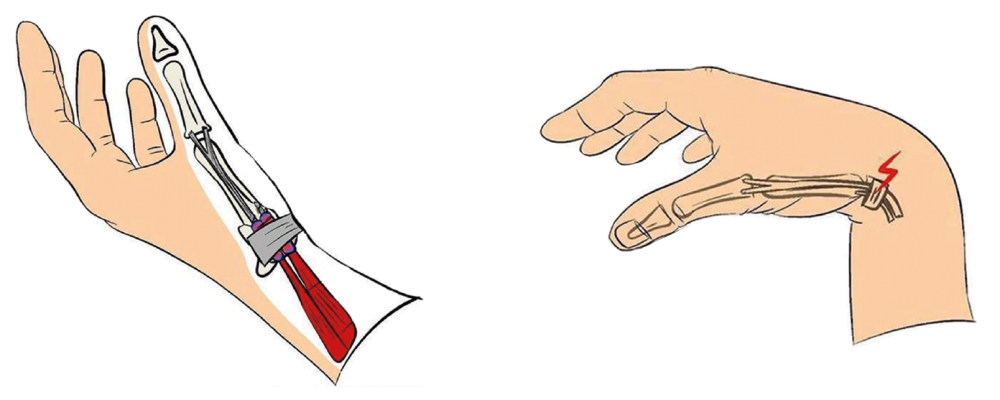 miguel.botton_Prancheta 1 (1)